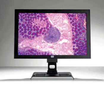 Imagen: El sistema de visualización de imágenes de patología integra el monitor de grado clínico y el sistema de pantalla de Barco (Imagen cortesía de PRNewsFoto/Ventana Medical Systems, Inc.).